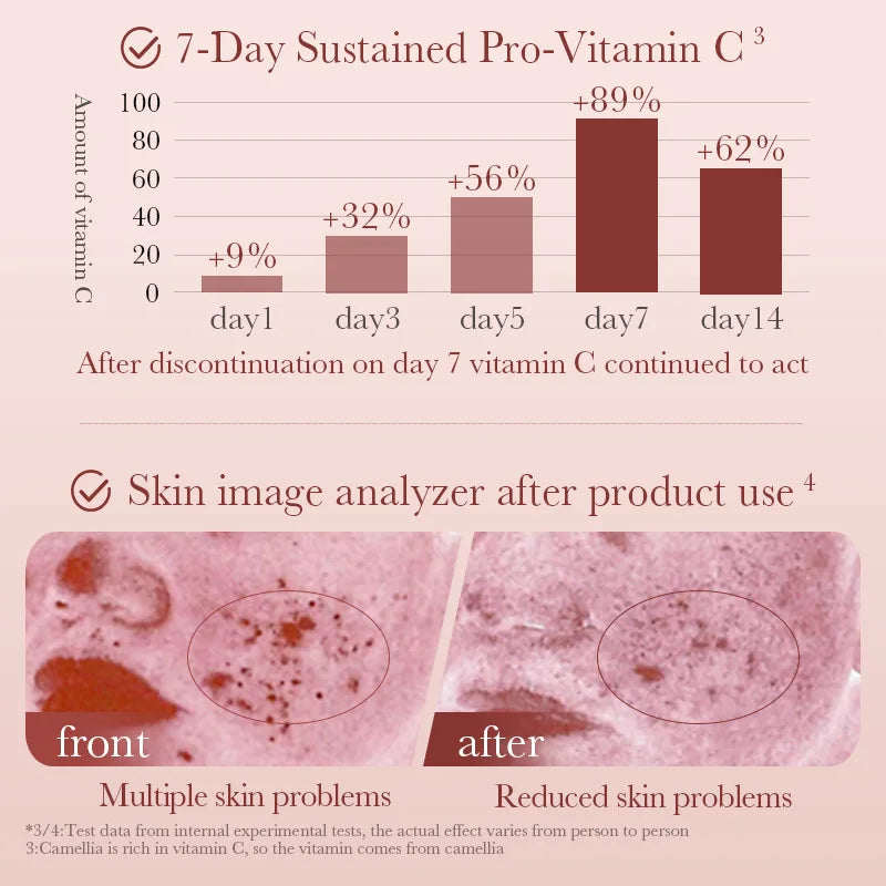 Camelia Skin Care Anti-aging Face Cream Serum Set Moisturizing Repair Set Nourishing Essence Toner Lotion Women's Skin Care
